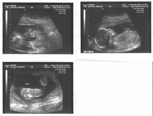 2005-07-15.seren-snyder.ultasound.2.southfield.mi.us 