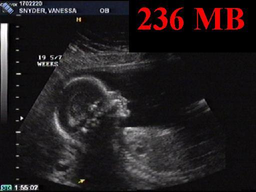 2005-07-15.seren-snyder.ultasound.video.640x480-236meg.southfield.mi.us 